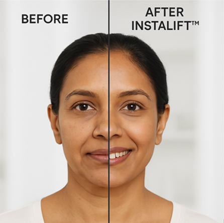 Medi-Facials & Peels